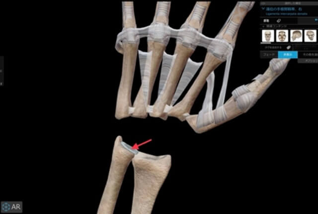 三角線維軟骨複合体（TFCC）