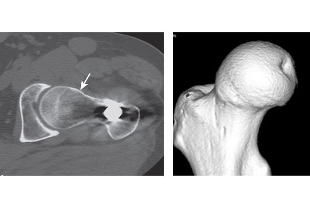 レントゲン、MRI、CT